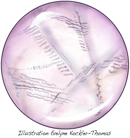 givres en zebrures amethyste